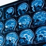 showing Energy Medicine within the brain that Terrye Mj can connect with to support people to feel more balanced and happy within themselves and their lives.